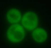 Yeast cells expressing a fluorescently-tagged prion that has been cured. Photo courtesy UMass Amherst/Serio lab.